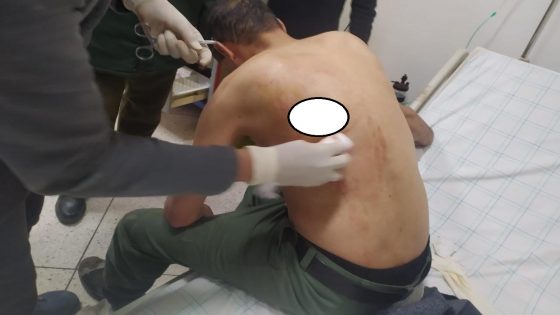 قائد محلقة إدارية بسوق السبت أولاد النمة يتعرض لاعتداء بالسلاح الأبيض على مستوى الكتف