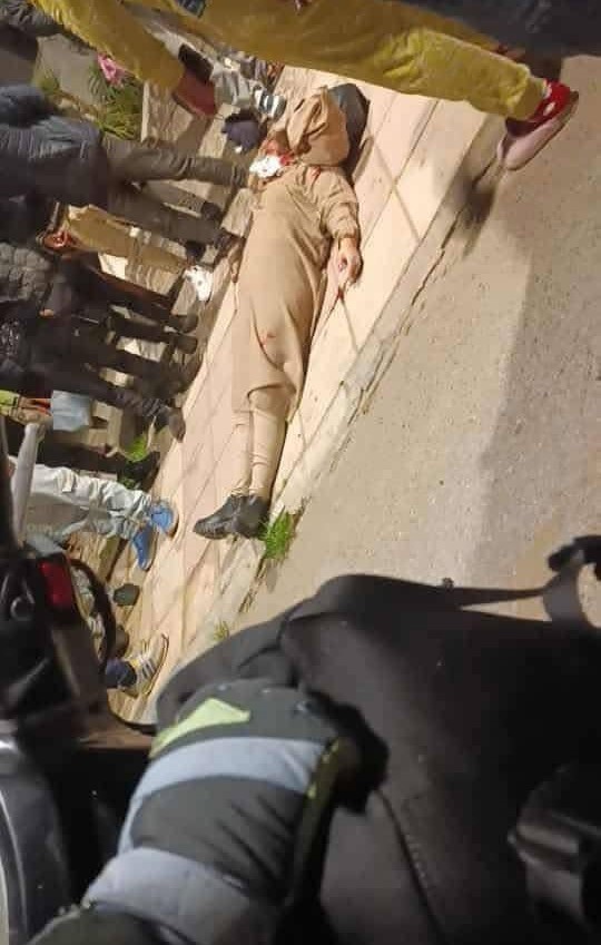 صورة للضــ حية التي نجت من محاولة قــ تل بشعة قبل قليل بمدينة مولاي بوسلهام