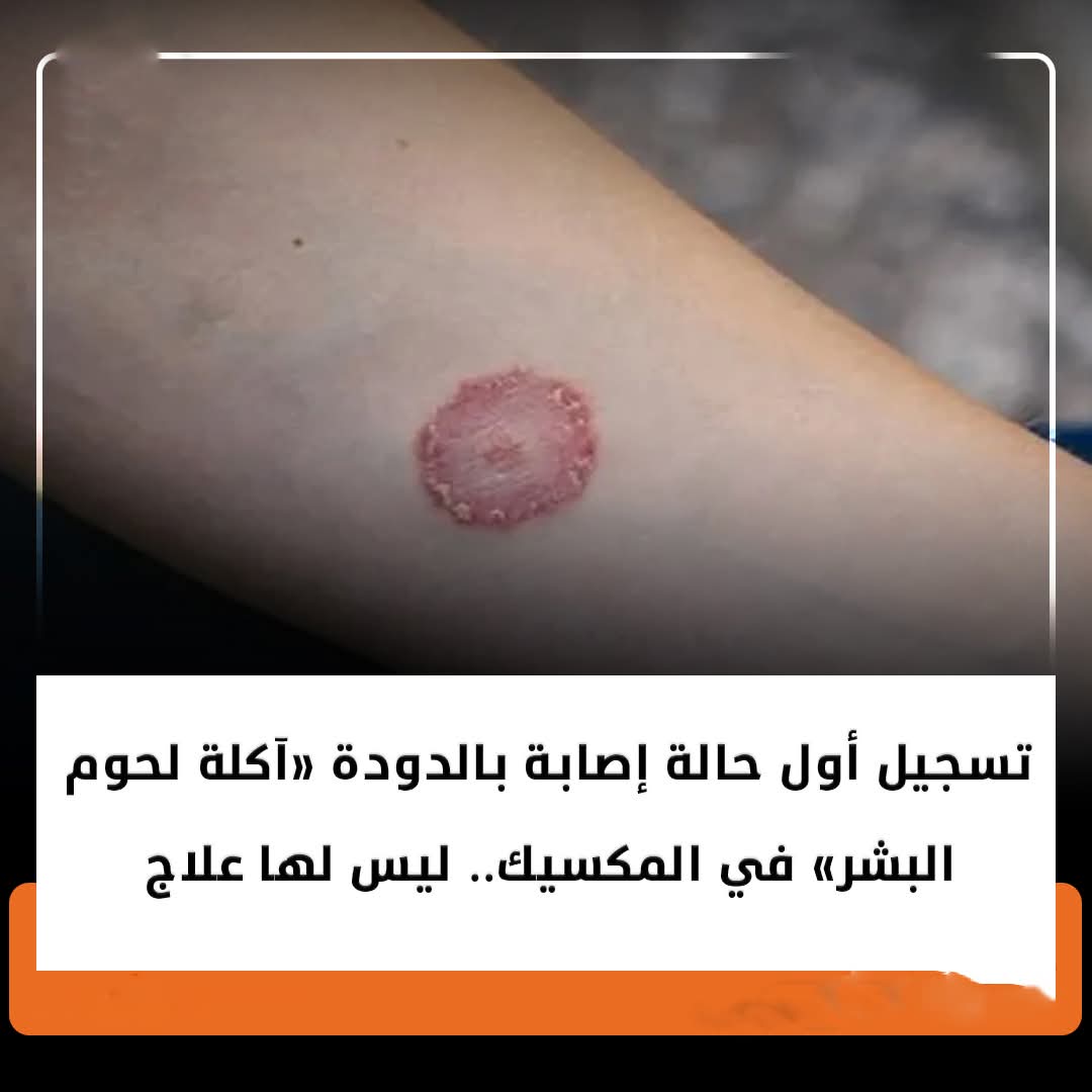 كــ ارثة صحية تــ هز المكسيك!