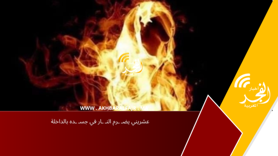 عشريني يضـ ـرم النـ ـار في جسـ ـده بالداخلة